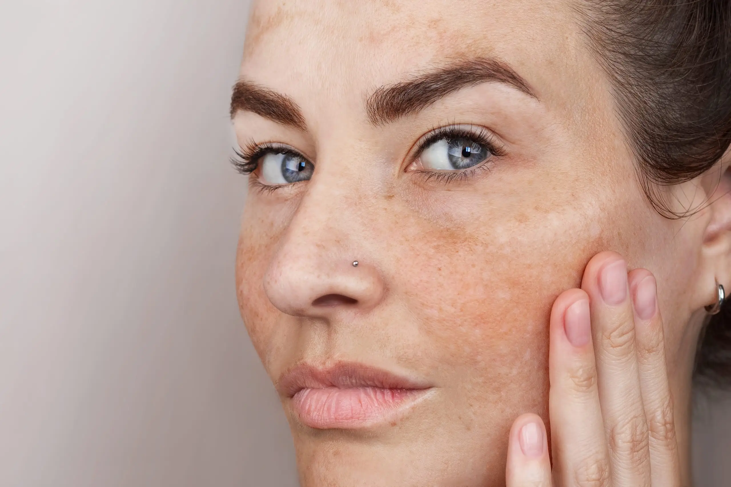 close-up-caucasian-womans-face-with-freckles-age-spots-age-spots-face-woman-with-blue-eyes-looks-camera